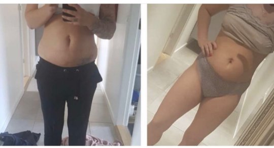 Før og efter 1 fedtfrysning på mave og sider og 1 bioslimming wrap